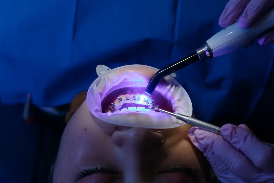 La importancia de la ortodoncia: ¿Cómo mejorar tu sonrisa?