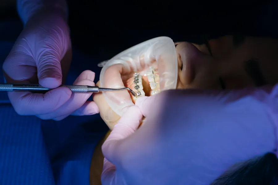 Los beneficios de la ortodoncia para la salud dental