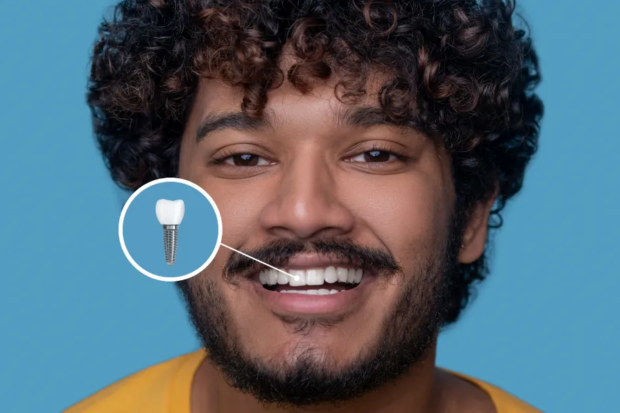 Implantes dentales y mejora de la calidad de vida
