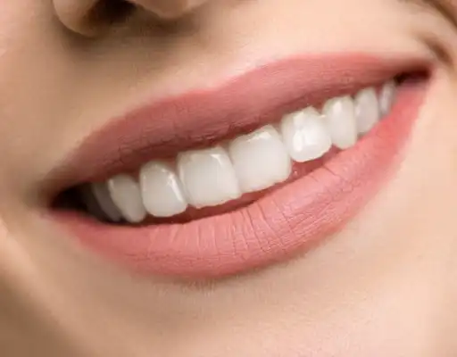 Clinica dental carillas tres forques dental