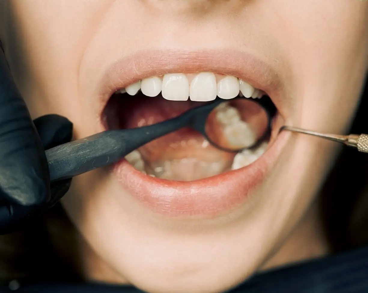 ¿A qué edad es bueno acudir al dentista