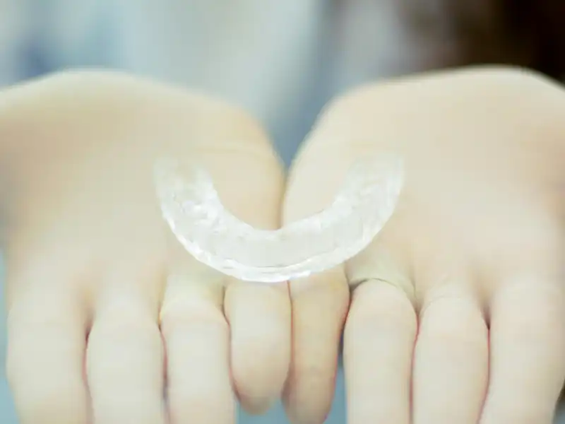 Opiniones del Invisalign. ¿Quién puede tener este tratamiento