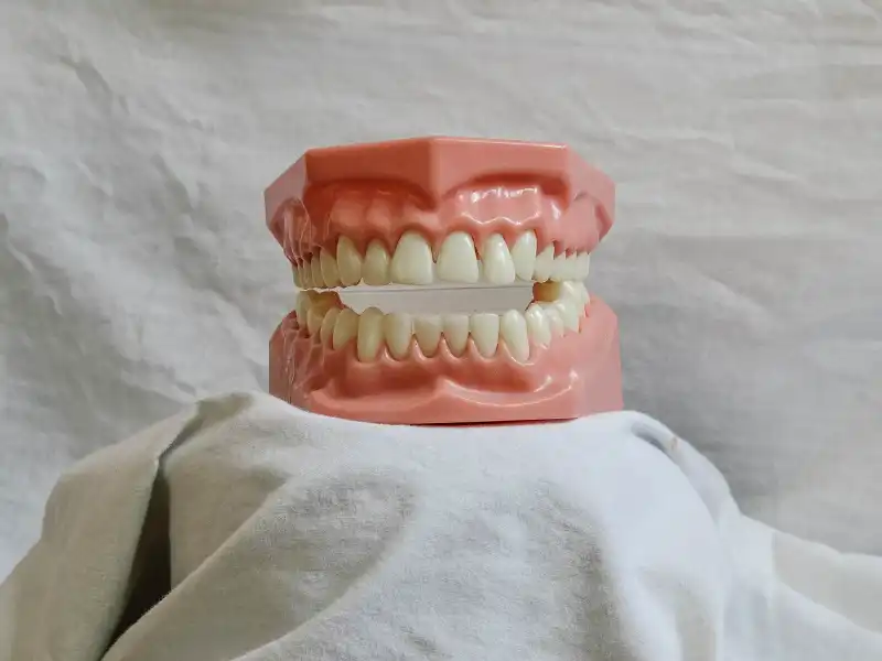¿Cuál es la mejor solución para reponer piezas dentales perdidas