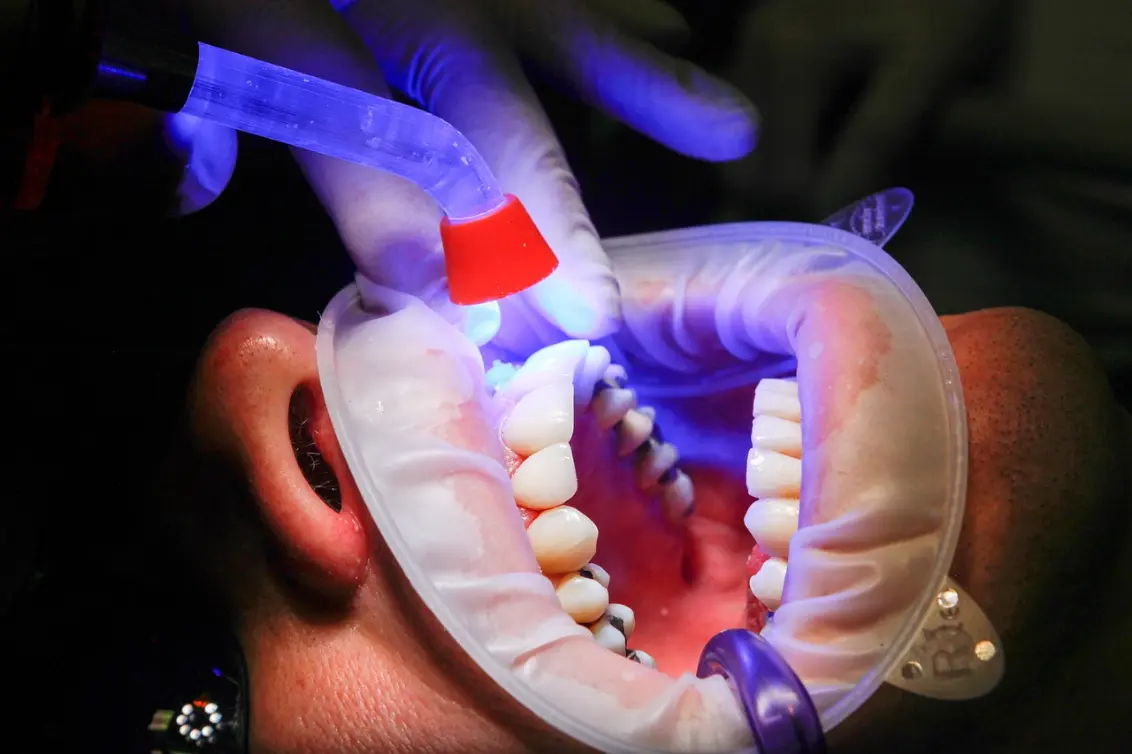 Descubra los beneficios de la implantología dental para su salud bucal
