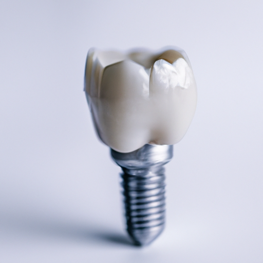 La implantología dental: su papel crucial en la prevención de enfermedades bucales