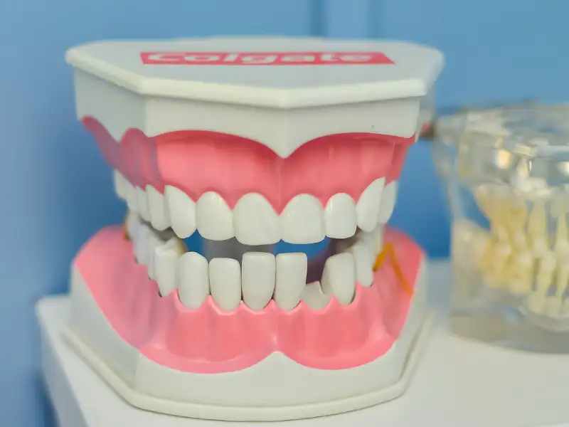 ¿Por qué elegir la implantología dental Descubre sus innumerables beneficios