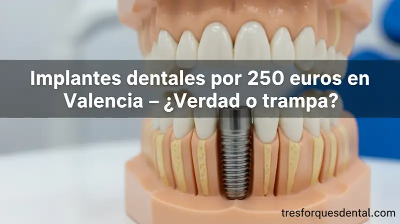 implantes-dentales-por-250-euros