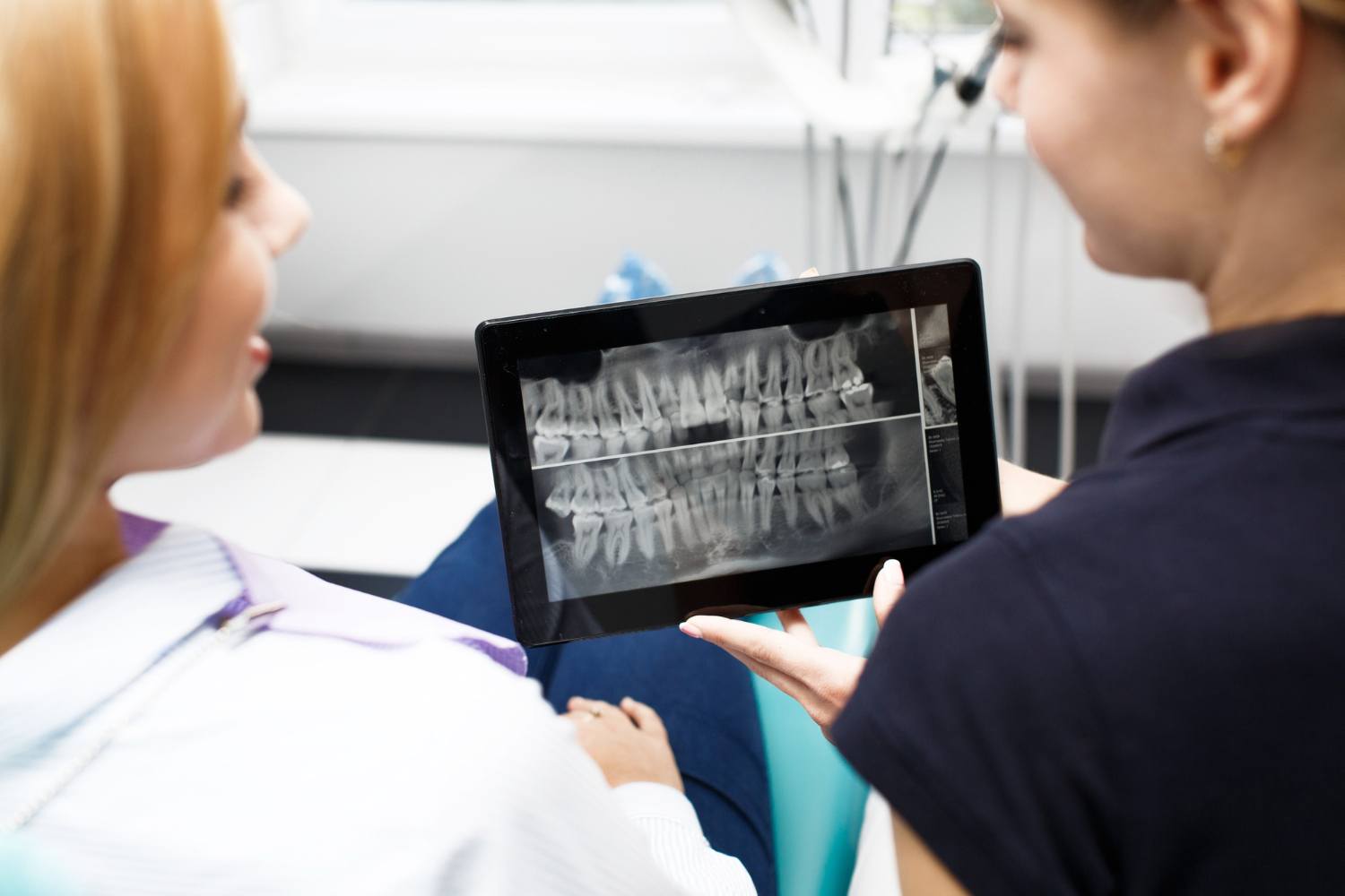 tratamientos implantes dentales carga inmediata valencia