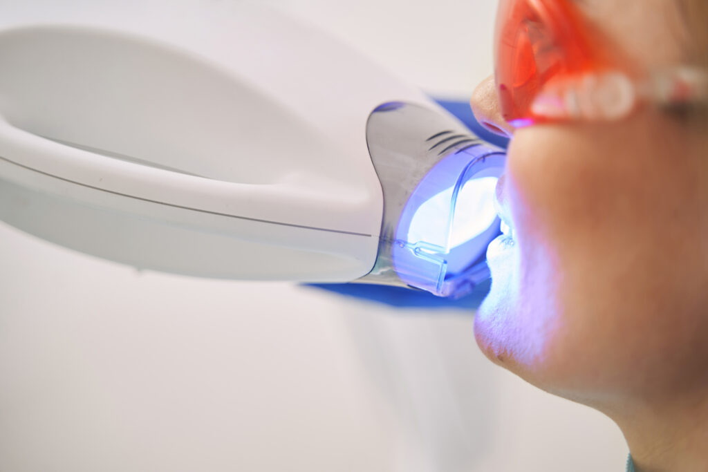 carga inmediata implantes dentales