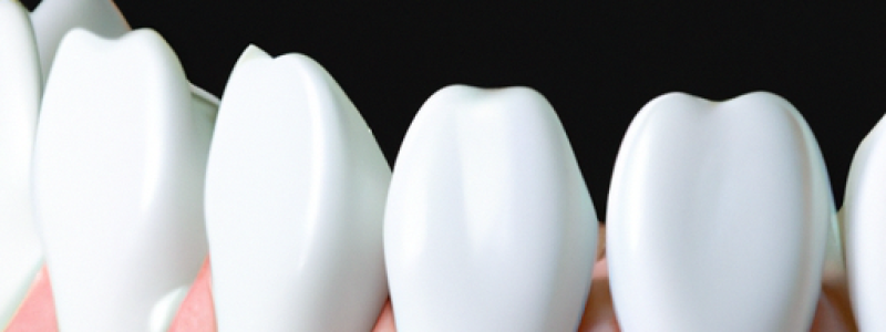 Dientes blancos, vida brillante: Mitos y verdades sobre el blanqueamiento dental Dientes blancos, vida brillante: Mitos y verdades sobre el blanqueamiento dental