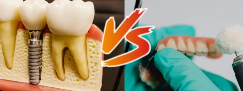 Dentaduras postizas vs. implantología dental ¿cuál es la mejor opción Dentaduras postizas vs. implantología dental ¿cuál es la mejor opción