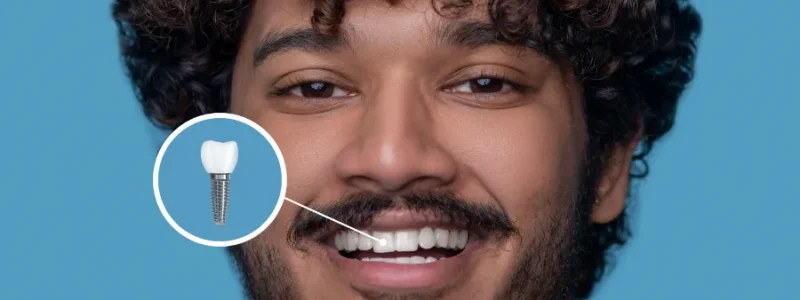 Implantes dentales y mejora de la calidad de vida