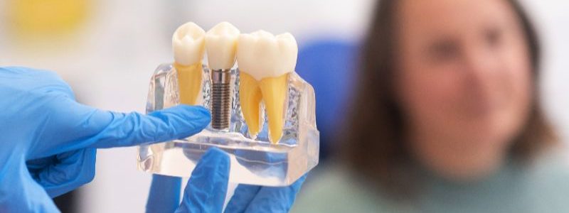 dentista-de-implantes-dentales-discutiendo-un-plan-de-tratamiento-con-el-paciente-sostiene-un-modelo-de-implante-dental (1)