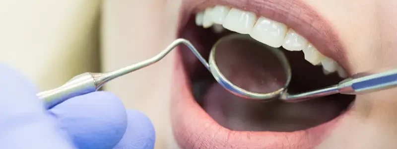 habitos-para-adoptar-si-quieres-lucir-una-sonrisa-perfecta habitos-para-adoptar-si-quieres-lucir-una-sonrisa-perfecta