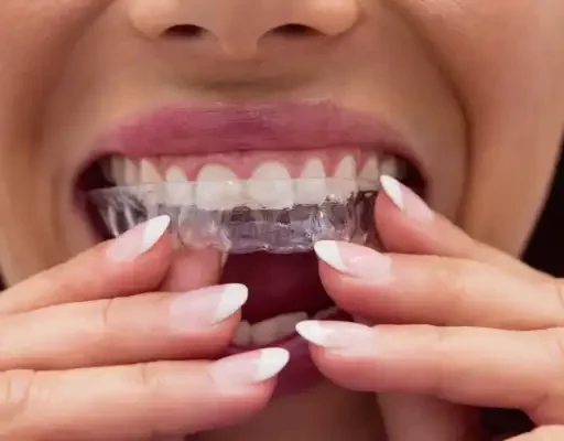 ortodoncia invisible barata tres forques dental dentista barato ortodoncia invisible barata tres forques dental dentista barato