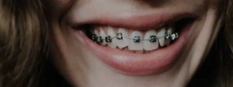 Cuidado Dental: Los Beneficios de la Ortodoncia Cuidado Dental: Los Beneficios de la Ortodoncia